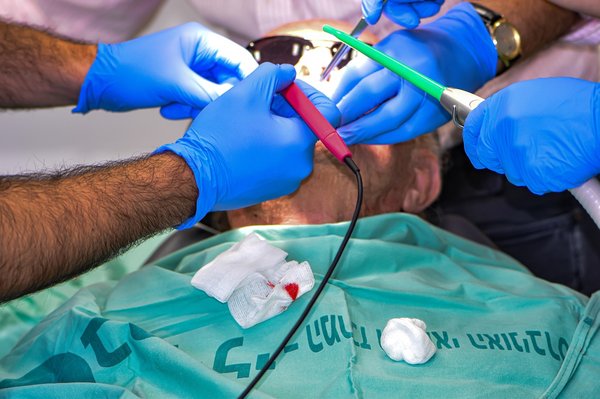 Jet dentaire hydropulseur : votre solution pour des gencives saines !